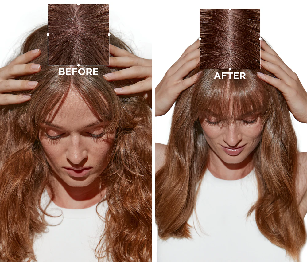 Kerastase Symbiose Bain Purete Anti-Pelliculaire шампунь-ванна проти лупи для чутливої шкіри голови, 250 мл